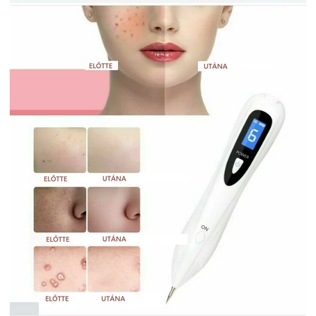 Vezeték nélküli kozmetikai toll, LCD kijelzővel és 7 cserélhető fejjel